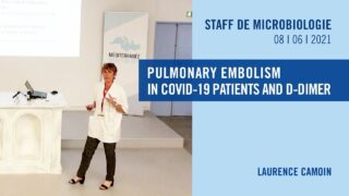 Pulmonary embolism in COVID-19 patients and D-Dimer