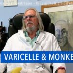 Varicelle & Monkeypox