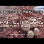 ActuQc : Histotripsie – Traitement du cancer par ultrasons approuvé par la FDA