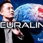 ActuQc : NEURALINK : Implant Cérébral.