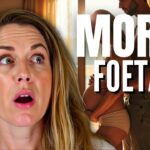 « Tout Allait Bien… Puis Tout S’est Enchaîné” (Décryptage) 👶⚡️