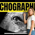 Échographies de grossesse, macrosomie, manque de liquide amniotique, déclenchement Échographies de grossesse, macrosomie, manque de liquide amniotique, déclenchement