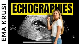 Échographies de grossesse, macrosomie, manque de liquide amniotique, déclenchement